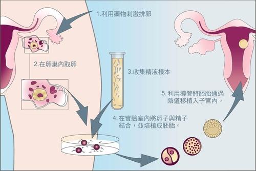 福州供卵生殖中心_怀孕试管婴儿后需要对胎儿做哪些检查？